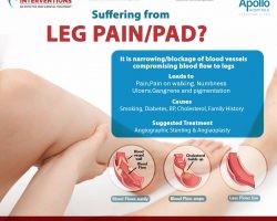 suffering from leg pain - Vascular Interventions