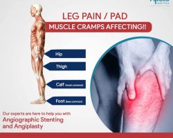Leg Pain/ PAD - Vascular Interventions