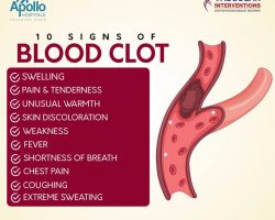 10 signs of blood clot - Vascular Interventions