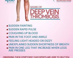 Signs of Deep Vein Thrombosis - Vascular Interventions