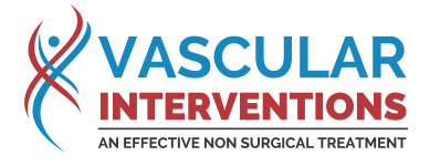 Best Vascular Treatment in Hyderabad | Vascular Interventions