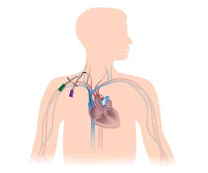 Central Lines and Drainage Procedures