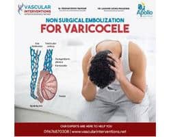Best vascular specialist in Hyderabad